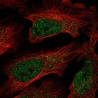 Immunofluorescent staining of human cell line U-2 OS shows localization to nucleoplasm.