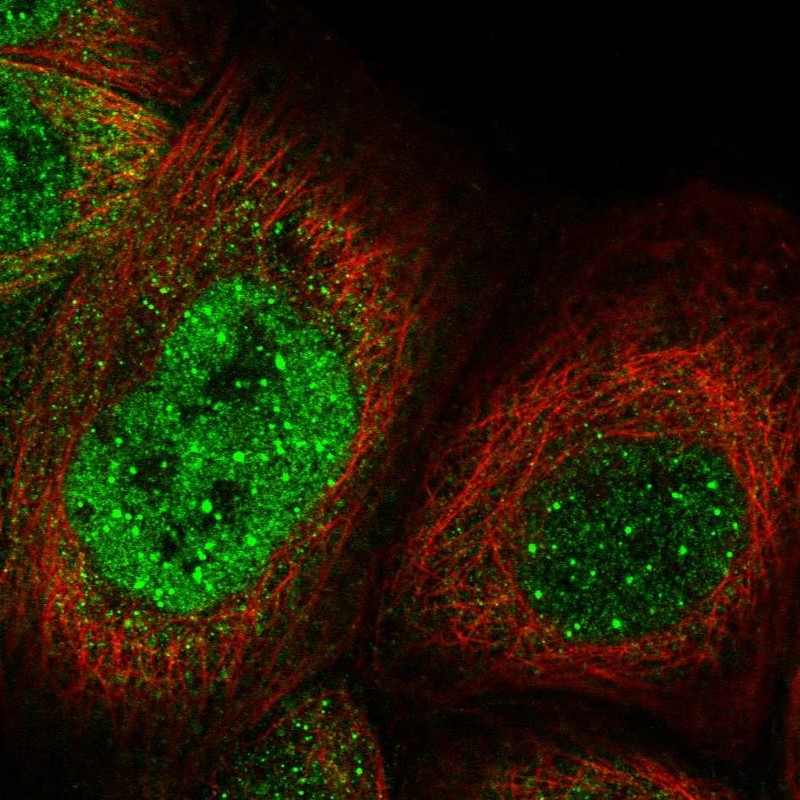 Anti-KNL1 Antibody