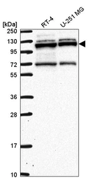 Anti-RBM15 Antibody