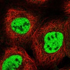 Immunofluorescent staining of human cell line A-431 shows localization to nucleoplasm.