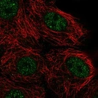 Anti-NUDT17 Antibody