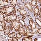 Anti-MTHFD2 Antibody