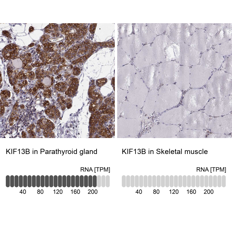 Anti-KIF13B Antibody
