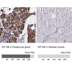 Anti-KIF13B Antibody
