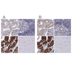 Immunohistochemical staining of human kidney, lymph node, parathyroid gland and skeletal muscle using Anti-KIF13B antibody HPA049655 (A) shows similar protein distribution across tissues to independent antibody HPA025023 (B).