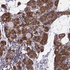 Immunohistochemical staining of human parathyroid gland shows high expression.