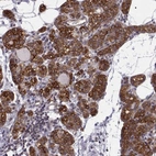 Immunohistochemical staining of human parathyroid gland shows high expression.