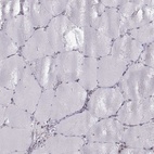 Immunohistochemical staining of human skeletal muscle shows low expression as expected.