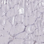 Immunohistochemical staining of human skeletal muscle shows low expression as expected.