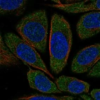 Immunofluorescent staining of human cell line SiHa shows localization to cytosol.