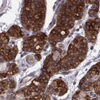 Immunohistochemical staining of human parathyroid gland using Anti-KIF13B antibody HPA049655.