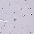 Immunohistochemical staining of human skeletal muscle using Anti-KIF13B antibody HPA049655.
