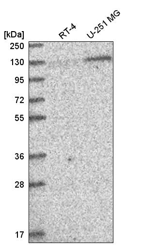 Anti-PUM2 Antibody