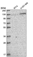 Anti-PUM2 Antibody