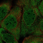 Immunofluorescent staining of human cell line A-431 shows localization to nuclear membrane & cytosol.