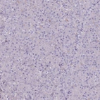 Immunohistochemical staining of human pancreas shows low expression as expected.