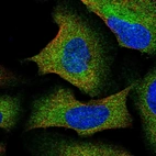 Immunofluorescent staining of human cell line U-2 OS shows localization to cytosol.