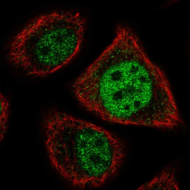Anti-ETV7 Antibody