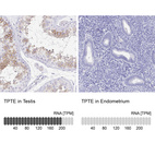 Anti-TPTE Antibody