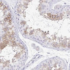 Immunohistochemical staining of human testis shows high expression.