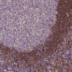 Anti-FGD2 Antibody