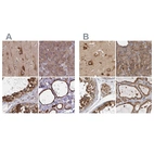 Immunohistochemical staining of human cerebral cortex, pancreas, testis and thyroid gland using Anti-BCAP29 antibody HPA049694 (A) shows similar protein distribution across tissues to independent antibody HPA029215 (B).