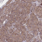 Immunohistochemical staining of human pancreas shows low expression as expected.
