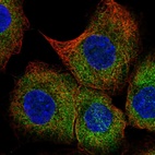 Immunofluorescent staining of human cell line A-431 shows localization to cytosol.