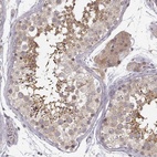 Anti-ERGIC2 Antibody