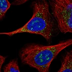 Immunofluorescent staining of human cell line U-2 OS shows localization to nucleoli & vesicles.