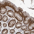 Anti-ATP13A1 Antibody
