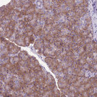 Anti-RPS11 Antibody