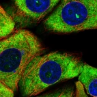 Immunofluorescent staining of human cell line MCF7 shows localization to nucleoli, cytosol & endoplasmic reticulum.