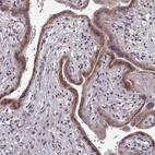 Anti-ACKR3 Antibody