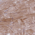 Immunohistochemical staining of human skeletal muscle shows moderate cytoplasmic positivity in myocytes.