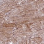 Immunohistochemical staining of human skeletal muscle shows moderate cytoplasmic positivity in myocytes.