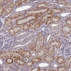 Immunohistochemical staining of human kidney shows strong cytoplasmic positivity in cells in tubules.