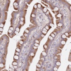 Anti-SPATS1 Antibody