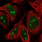 Anti-ZNF507 Antibody