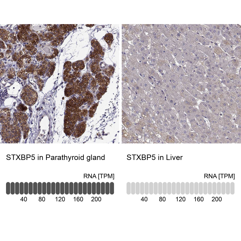 Anti-STXBP5 Antibody