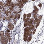 Immunohistochemical staining of human parathyroid gland shows high expression.