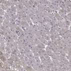 Immunohistochemical staining of human liver shows low expression as expected.