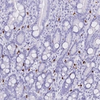 Immunohistochemical staining of human duodenum shows strong cytoplasmic positivity in a subset of lymphoid cells.