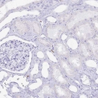 Immunohistochemical staining of human kidney shows no cytoplasmic positivity in cells in tubules as expected.
