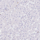 Immunohistochemical staining of human liver shows no cytoplasmic positivity in hepatocytes as expected.