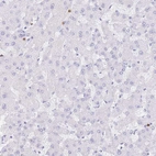Immunohistochemical staining of human liver shows no cytoplasmic positivity in hepatocytes as expected.
