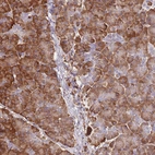 Anti-FRAT2 Antibody