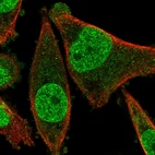 Immunofluorescent staining of human cell line PC-3 shows localization to nucleoplasm.