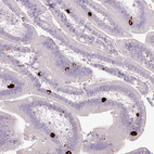Immunohistochemical staining of human duodenum shows strong cytoplasmic positivity in enteroendocrine cells.