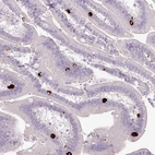 Immunohistochemical staining of human duodenum shows strong cytoplasmic positivity in enteroendocrine cells.